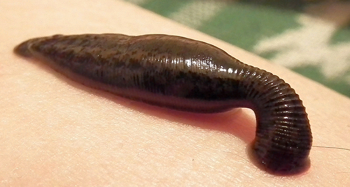 Правила применения пиявок в медицинских целях и их достоинства