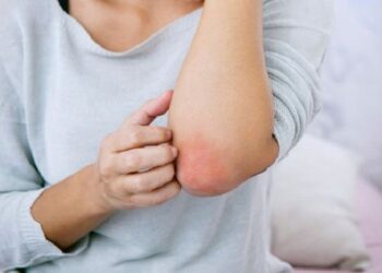 Суха шкіра на ліктях та колінах: основні причини та як уникнути