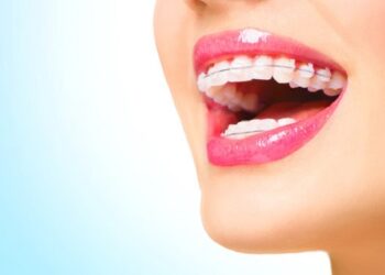 Виправлення прикусу в клініці «Усмішка» – шлях до красивої та здорової посмішки